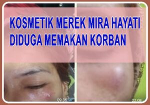 Kosmetik Mira Hayati Diduga Memakan Korban